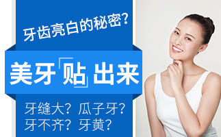 牙齿贴面