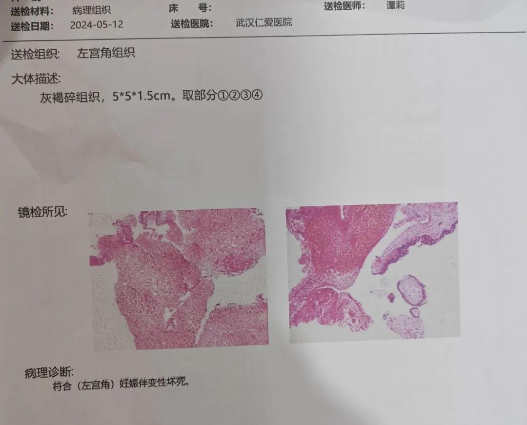 胡女士病检结果